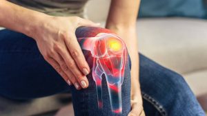 peptides, joint pain, mobility, arthritis, osteoarthritis, cartilage repair, tendon healing, ligament repair, inflammation, collagen peptides, hydrolyzed collagen, BPC-157, TB-500, thymosin beta-4, GHK-Cu, copper peptide, IGF-1, tissue regeneration, connective tissue, synovial fluid, joint lubrication, flexibility, stiffness relief, anti-inflammatory, angiogenesis, growth factors, recovery, injury repair, tendonitis, ligament sprain, cartilage health, joint health, musculoskeletal health, regenerative medicine, amino acids, protein synthesis, physical therapy, pain management, sports medicine, healthy aging, degenerative joint disease, mobility support, pain relief, collagen synthesis, cell migration, joint function, exercise recovery, chronic pain, healing peptides, cartilage regeneration, joint supplements, quality of life